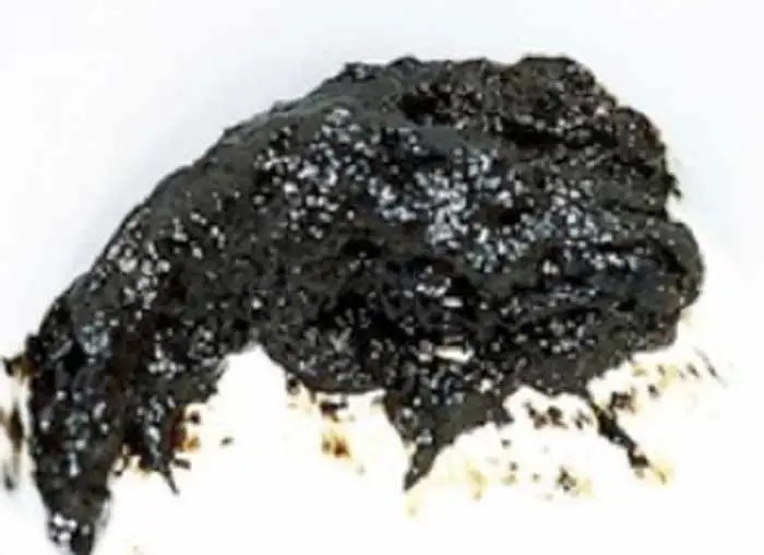 Black Specks in Stool Causes and Solutions
