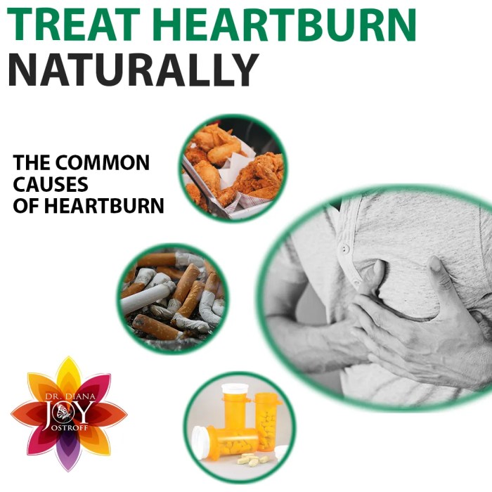 Remedies for Heartburn Relief A Comprehensive Guide