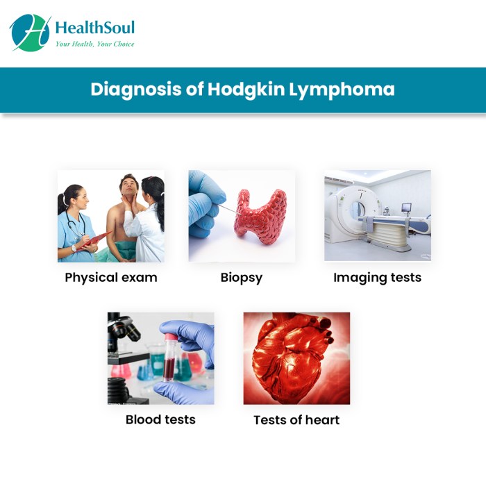 Non hodgkin lymphoma overview