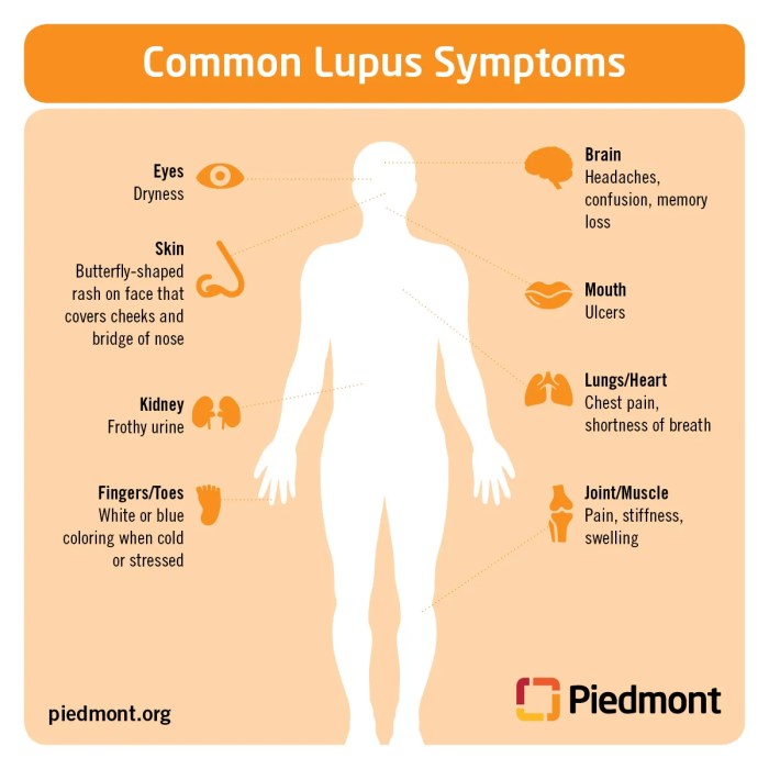 Lupus: Symptoms, Causes, Diagnosis, Treatment, and Coping How lupus is diagnosed