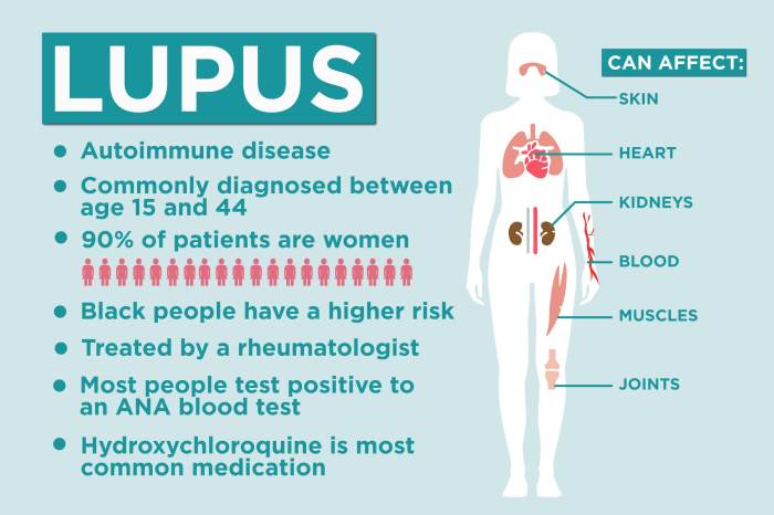 Systemic lupus erythematosus | MDedge Family Medicine Lupus and birth control