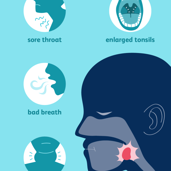 Chronic and recurrent tonsillitis