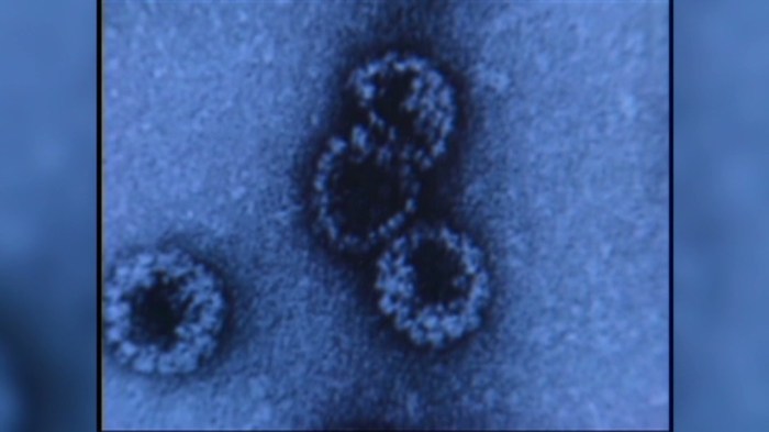 HPV test Hpv throat cancer link study
