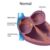 Atrial Fibrillation Drugs to Avoid A Comprehensive Guide