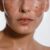 Causes of Dark Spots Unveiling the Secrets