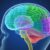 Brain Activity After Cardiac Arrest Understanding Recovery