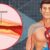 What Causes High Cholesterol in Women?