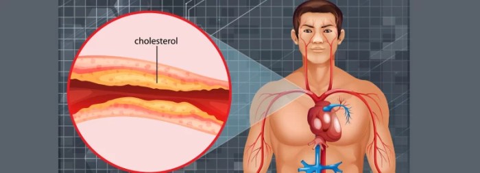 High cholesterol facts and statistics
