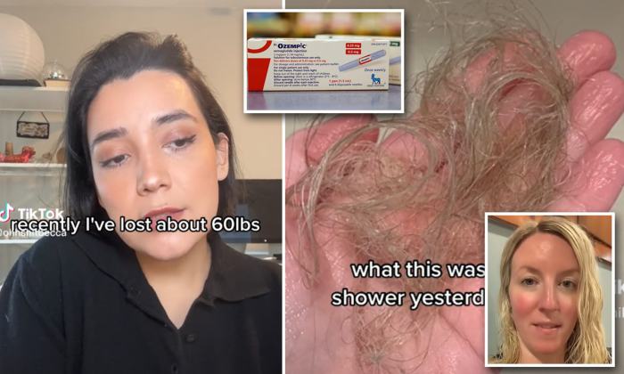 12+ Wegovy Hair Loss | EylemFaizaan Wegovy hair loss risk