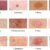 What Are Macule Skin Blemishes? A Comprehensive Guide