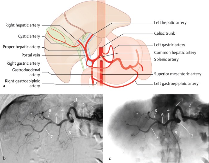 Hepatic Artery Common hepatic artery anatomy