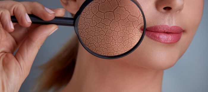 Oily Skin vs. Dry Skin: Understanding the Key Differences Skin picking and autoimmune disorders