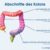 Colon Cancer Causes Risk Factors Unveiled