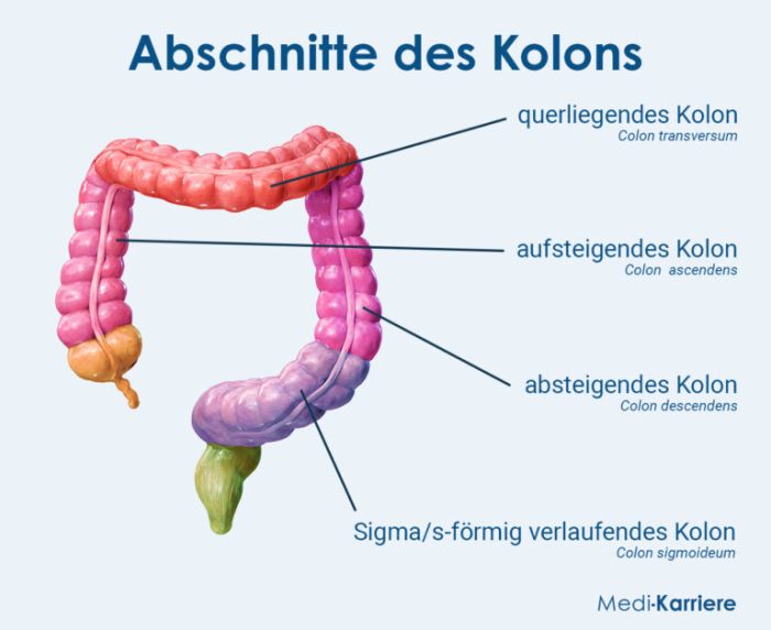 Colon cancer causes risk factors