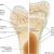 What is Bone Marrow Edema? A Deep Dive