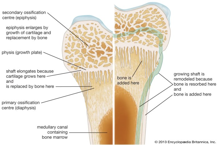 What is Bone Marrow Edema? A Deep Dive