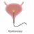 Cystogram Uses Side Effects & Procedure Results