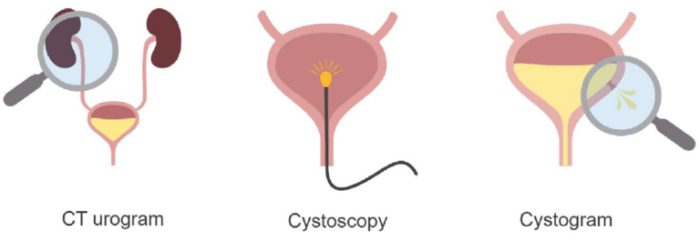 Cystogram uses side effects procedure results