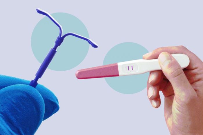 What Are the Chances and Signs of Pregnancy with an IUD? How to manage an iud pregnancy