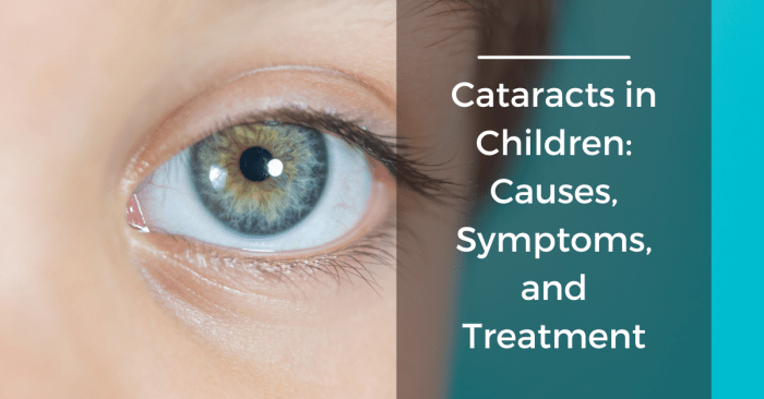 Congenital cataract - Βλέμμα Congenital cataracts vision loss babies children