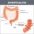 Diverticulitis Signs, Symptoms, and Complications