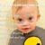 Cri du Chat Syndrome Understanding the Condition