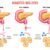 Diabetes and Liver Disease A Deep Dive