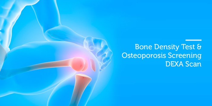 What is a dexa scan
