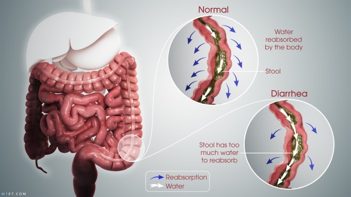 Diarrhea and weight loss