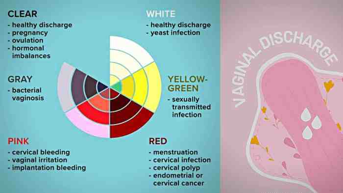 Vaginal Discharge Color Guide A Deep Dive