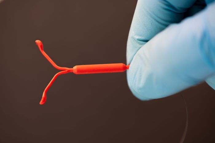 IUD Removal: What To Expect and When To Remove | Ezra How to manage an iud pregnancy