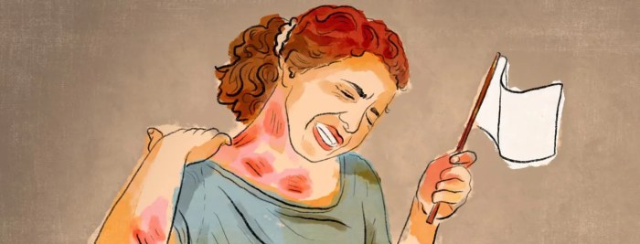 Say Goodnight To Itching! The Remedy For Itchy Skin At Night – Dermeleve® Itchy skin at night