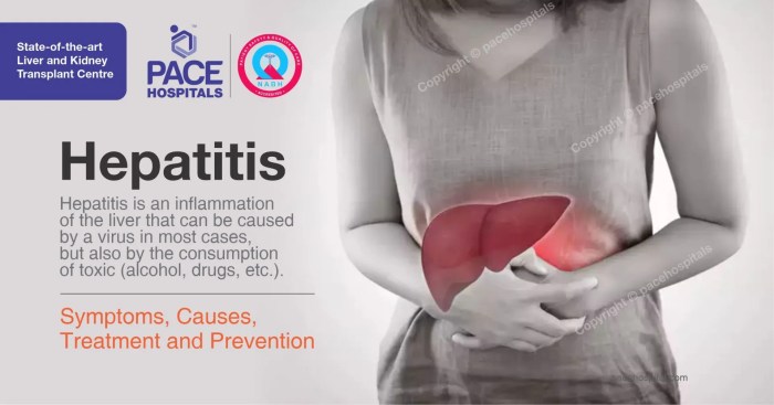 Hepatitis d overview and more