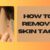 How to Prevent Skin Tags A Comprehensive Guide