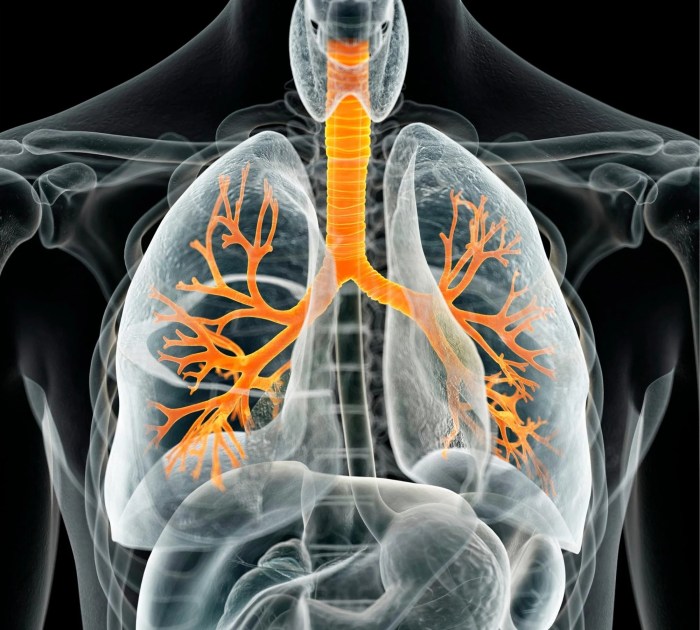 Lung cancer in women