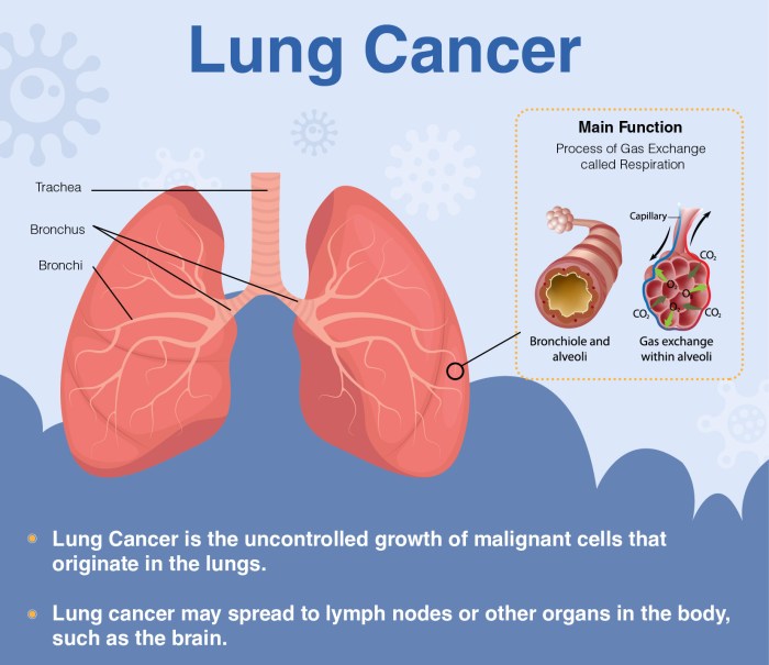 Edexcel IGCSE Biology 复习笔记 2.7.5 Human Gas Exchange System-翰林国际教育 Lung pain symptoms causes and diagnosis