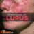 Lupus and the Eyes A Comprehensive Guide