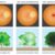 Macular Degeneration Coping Support and Living Well