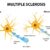Dysesthesia and Multiple Sclerosis A Deep Dive