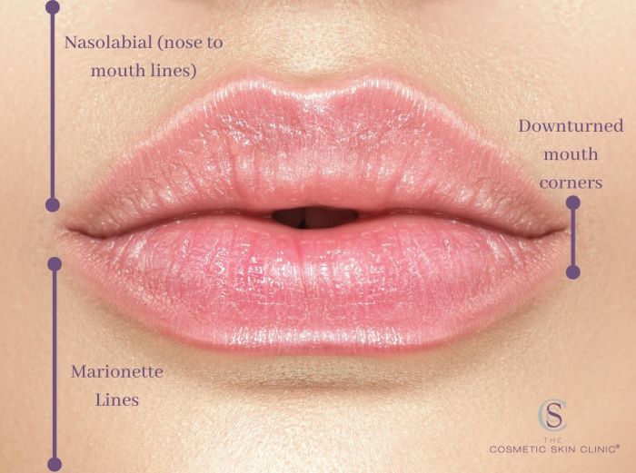 Mouth throat appearance tonsillectomy