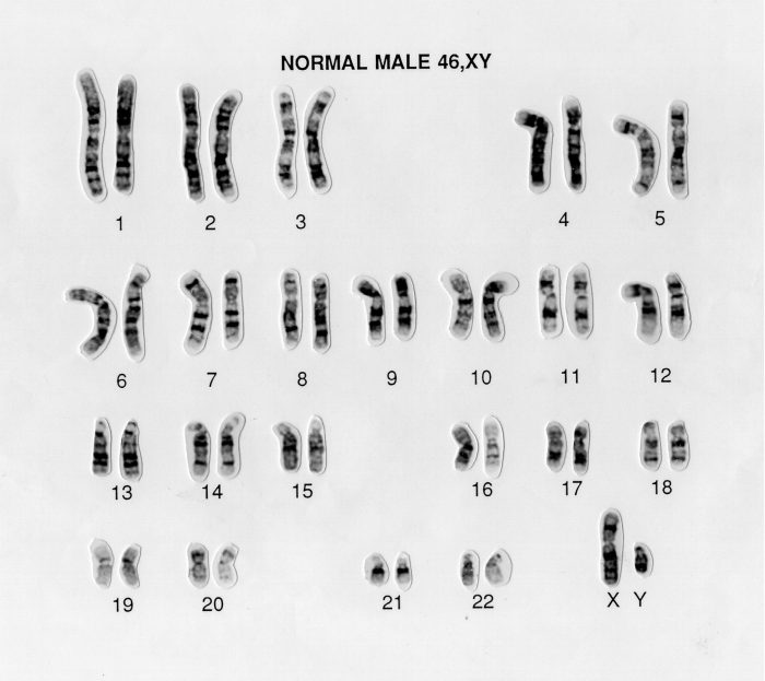 What is a karyotype