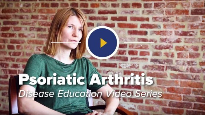 Tips for managing psoriatic arthritis and depression