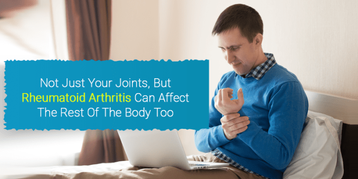 Rheumatoid arthritis effects on body systems