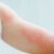 Itchy Skin at Night Understanding and Relief