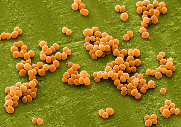 Staphylococcus aureus – Să crești mare, odoraș! Staph infection vs mrsa