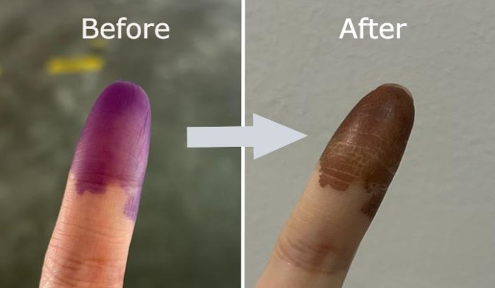 What Causes a Purple Finger? Unveiling the Mystery