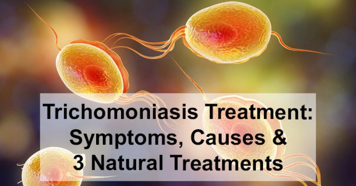 Treat Trichomoniasis at Home A Guide