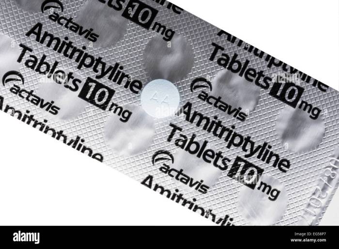Amitriptyline for Migraine Prevention A Deep Dive