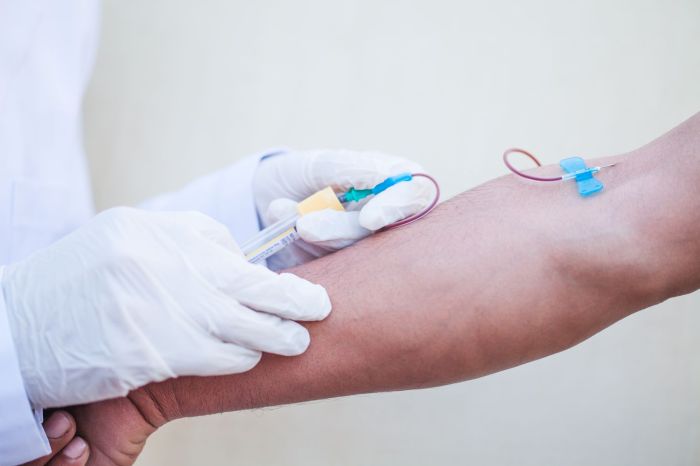 Sodium blood test results