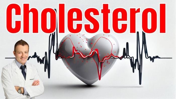 What causes high cholesterol in women
